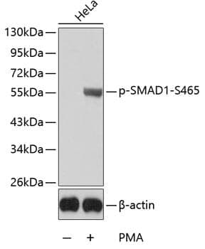 Anti-SMAD1 (phospho S465) Antibody