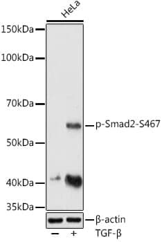 Anti-SMAD2 (phospho S467) Antibody