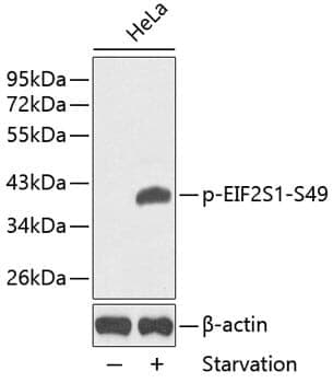 Anti-eIF2a (phospho S49) Antibody