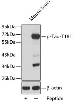 Anti-Tau (phospho T181) Antibody - Identical to Novus (NB100-82245)