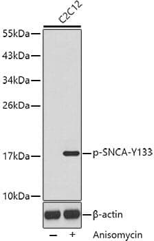 Anti-SNCA (phospho Y133) Antibody - Identical to Abcam (ab194910)