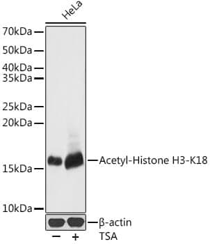Anti-Histone H3 (acetyl K18) Antibody