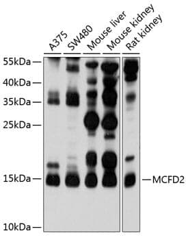 Anti-MCFD2 Antibody