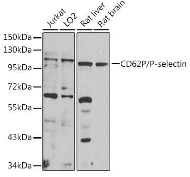 Anti-SELP Antibody