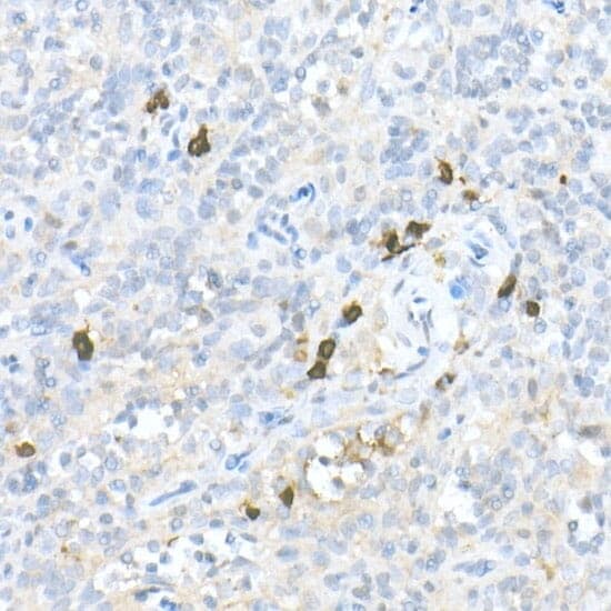 Anti-CCL22 Antibody
