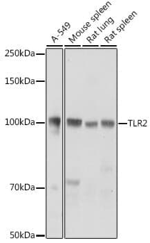 Anti-TLR2 Antibody
