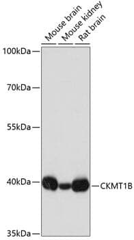 Anti-CKMT1B Antibody