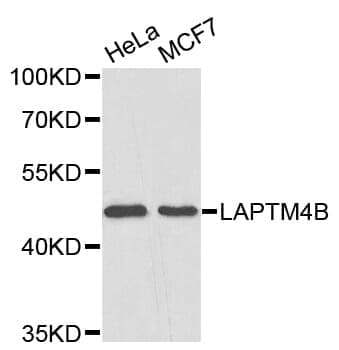 Anti-LAPTM4B Antibody