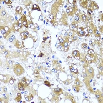 Anti-IL4 Antibody