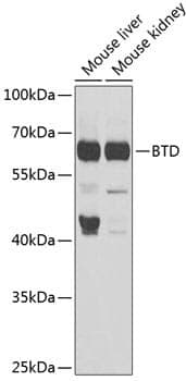 Anti-BTD Antibody