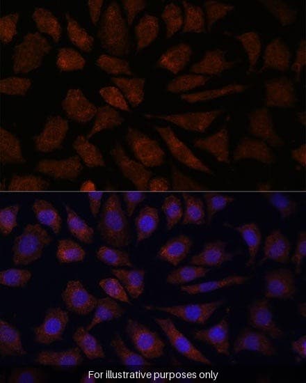 Human OAS3/2'-5'-oligoadenylate synthase 3 ELISA Kit