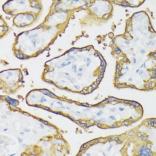 Anti-ALPP Antibody