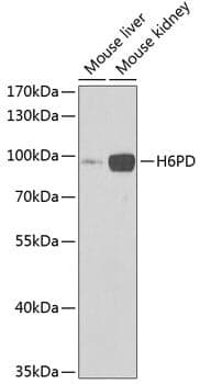 Anti-H6PD Antibody
