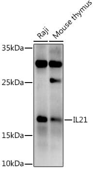 Anti-IL21 Antibody