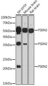 Anti-PSEN2 Antibody