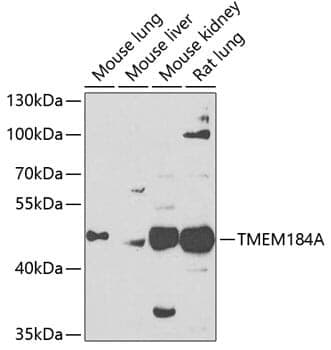 Anti-TMEM184A Antibody