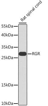 Anti-RGR Antibody