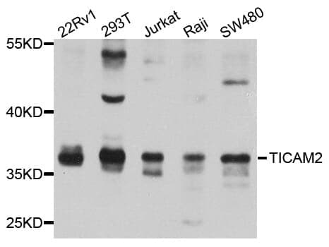 Anti-TICAM2 Antibody