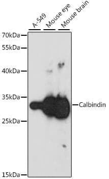 Anti-CALB1 Antibody