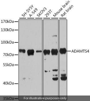 Human ADAMTS4 ELISA Kit