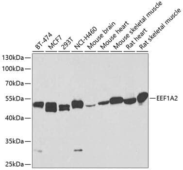 Anti-EEF1A2 Antibody
