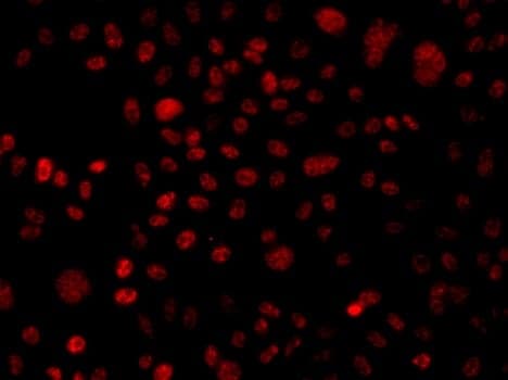 Anti-BAF250 Antibody