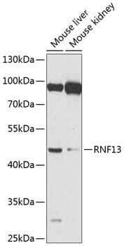 Anti-RNF13 Antibody