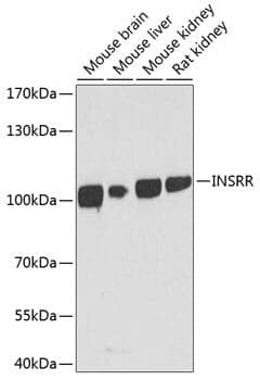 Anti-INSRR Antibody