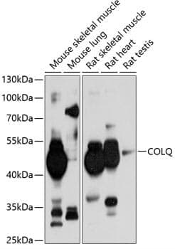 Anti-COLQ Antibody