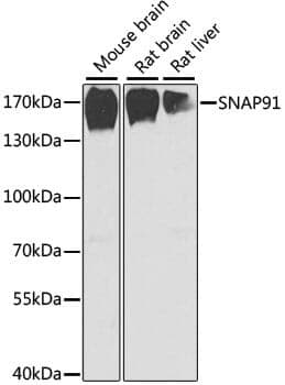Anti-SNAP91 Antibody