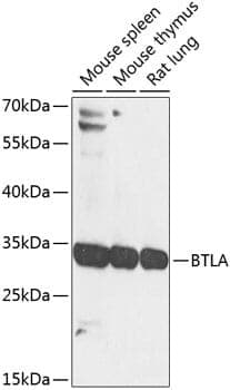 Anti-BTLA Antibody