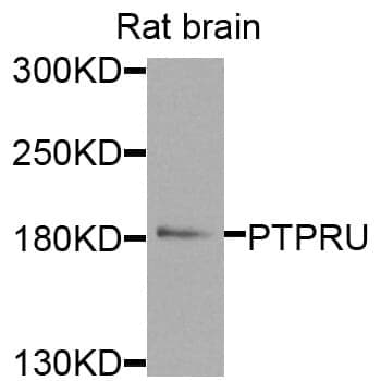 Anti-PTPRU Antibody