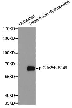 Anti-CDC25B (phospho S149) Antibody