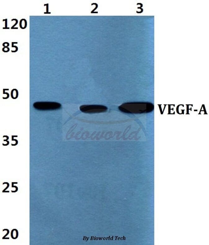 Anti-VEGF-A (L98) Antibody