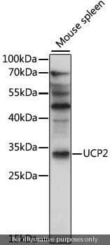 Human UCP2 ELISA Kit