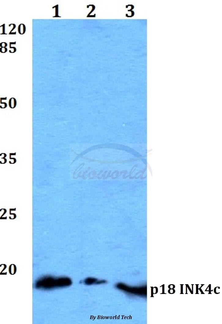 Anti-p18 INK4c (D142) Antibody
