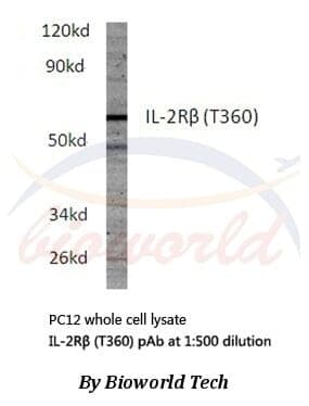 Anti-IL-2Rβ (T360) Antibody