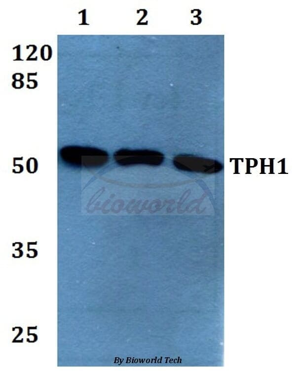 Anti-TPH1 (K54) Antibody