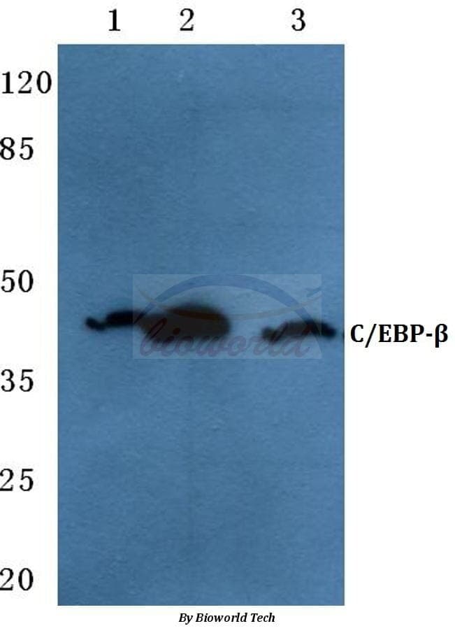 Anti-C/EBP-β (V259) Antibody