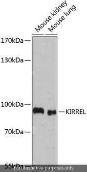 Human KIRREL ELISA Kit