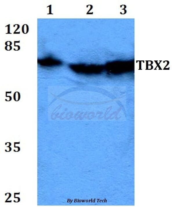 Anti-TBX2 (N280) Antibody