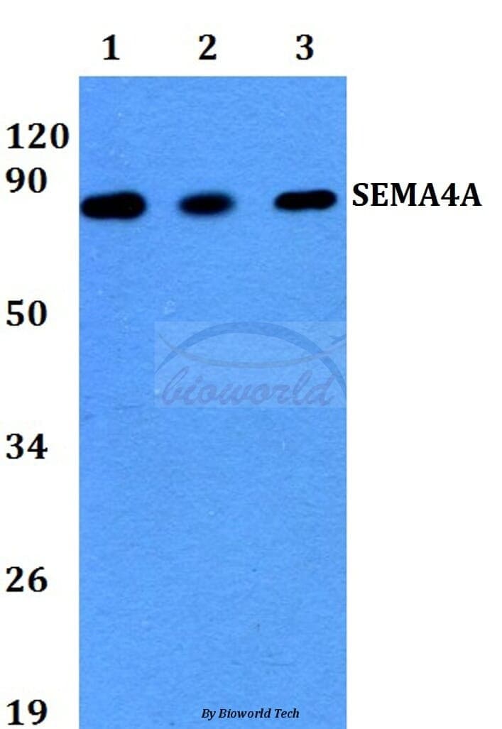Anti-SEMA4A (N532) Antibody
