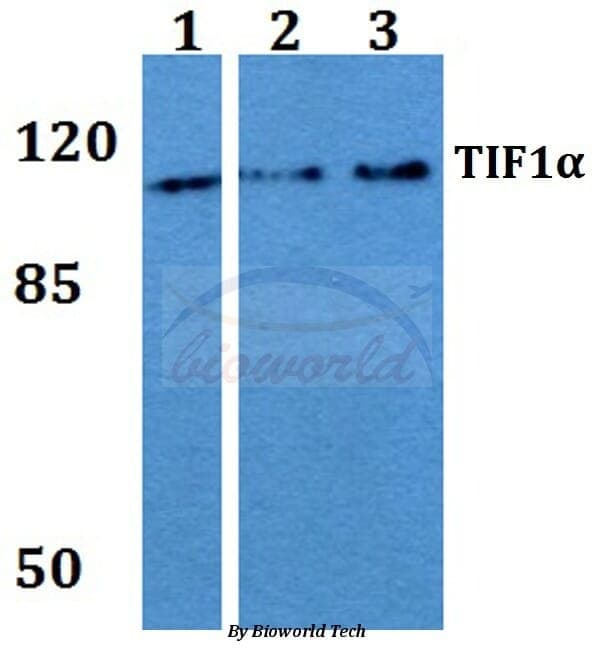 Anti-TIF1α (Q1034) Antibody