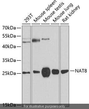 Human NAT8L ELISA Kit