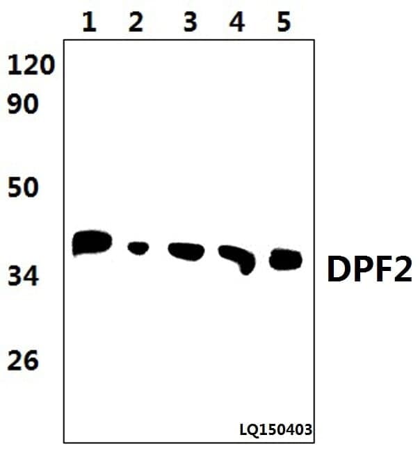 Anti-DPF2 (E174) Antibody