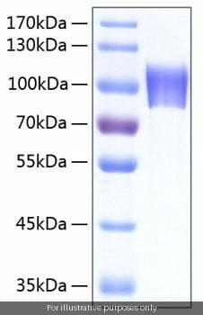 Human NLGN4X ELISA Kit