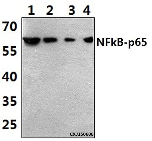 Anti-NFkB-p65 (K303) Antibody