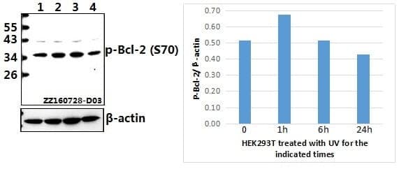 Anti-Bcl-2 (phospho-S70) Antibody