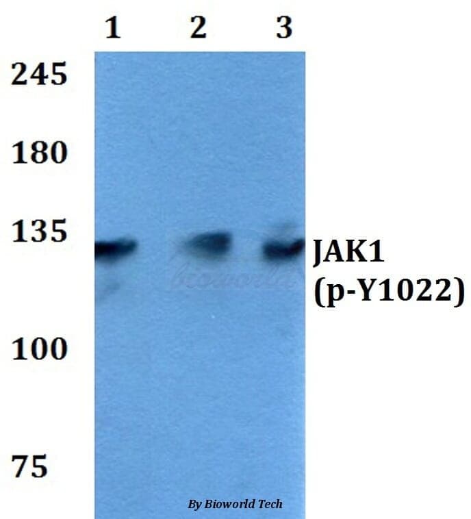 Anti-JAK1 (phospho-Y1022) Antibody