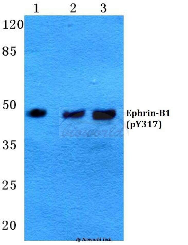 Anti-Ephrin-B1 (phospho-Y317) Antibody
